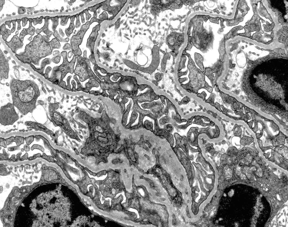 Kidney glomerulus